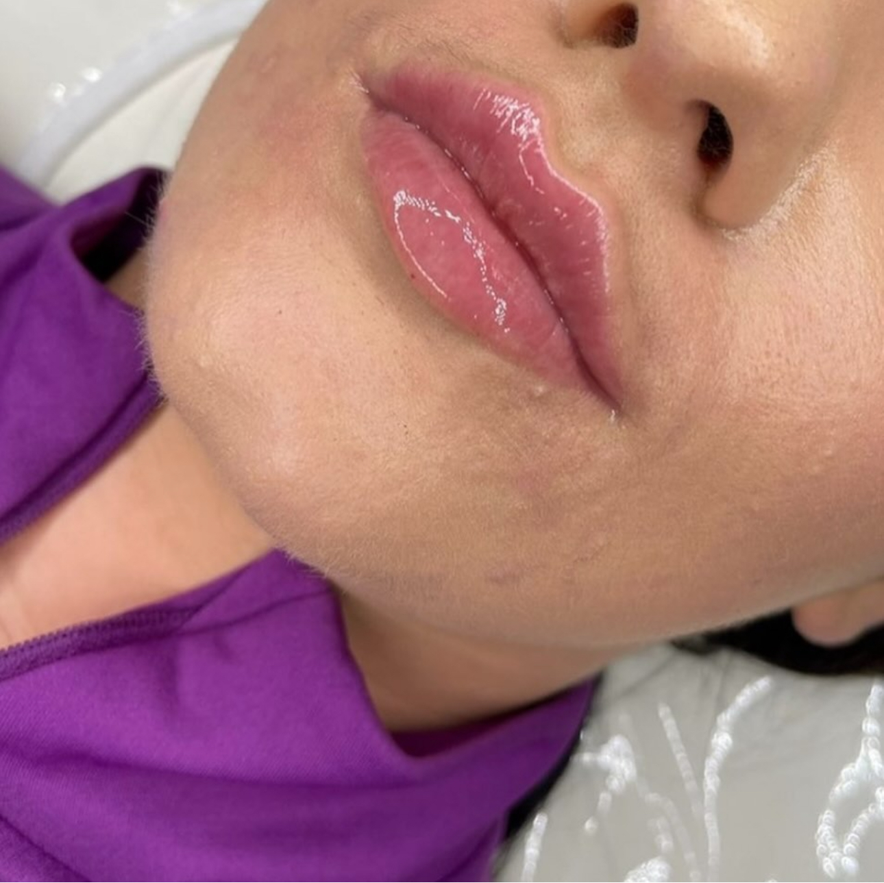 Luxury Facial Treatment