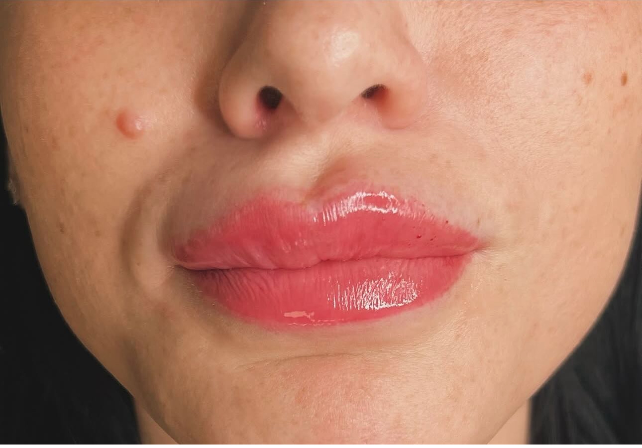 Dermaplaning Special